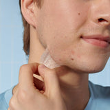 Mighty Patch Face – The Ultimate XL Acne Patch